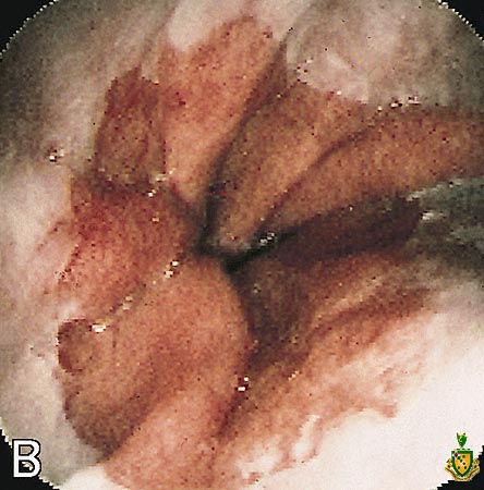 Figure 5 4
