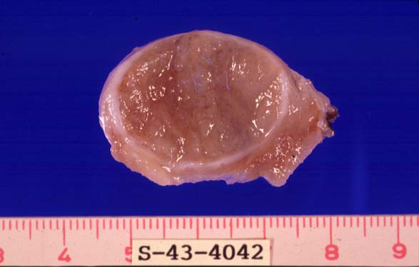 gross01