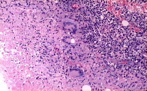 General Pathology Inflammation