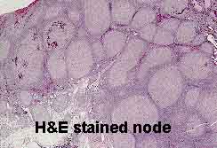 H&E stained tissue