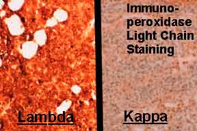 Light chain staining