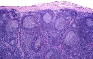 Germinal Center Low Power Images
