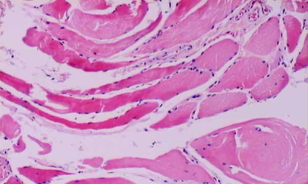 General Pathology.cell Injury