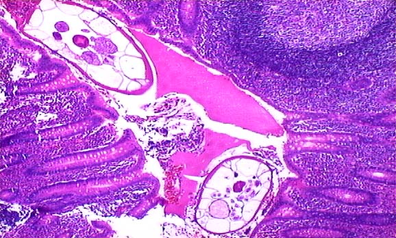 General Pathology....Infection