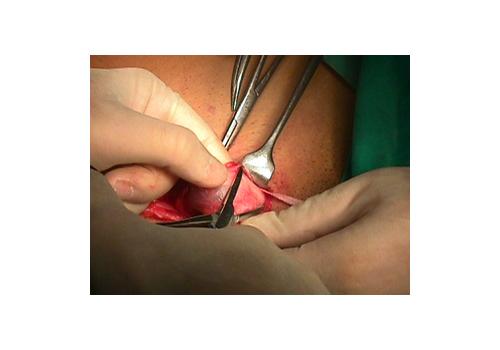 herniar15.JPG (78021 bytes)