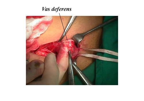 herniar18.JPG (49333 bytes)