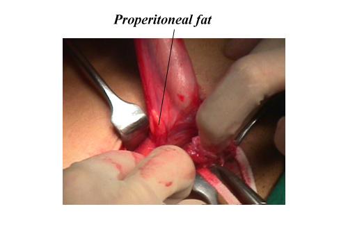 herniar27.JPG (79263 bytes)