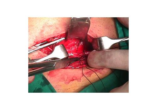 herniar41.JPG (54060 bytes)