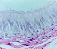 10. The Type Of Epithelium As Seen In The Screen, Is 